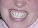 lindsay's teeth.JPG (62326 bytes)